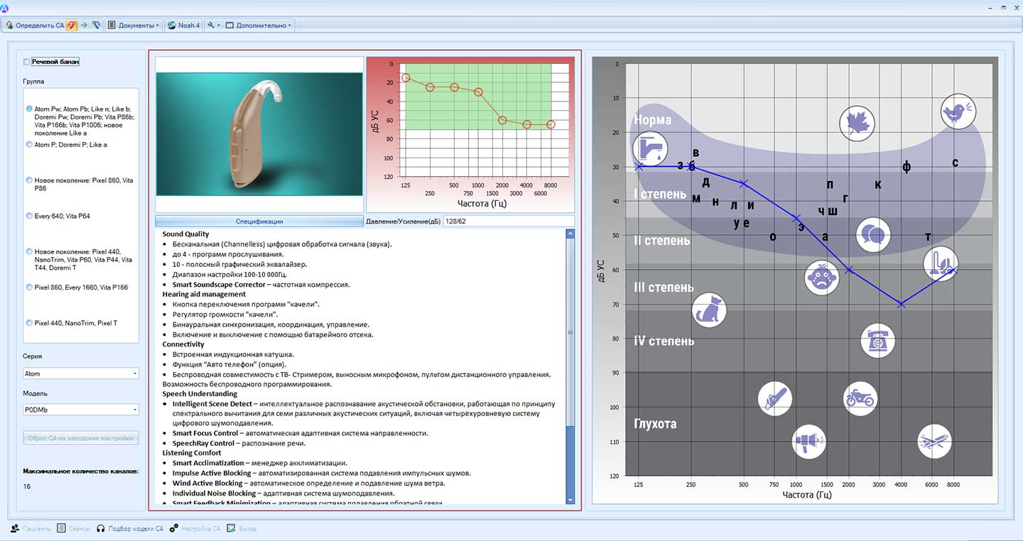 Как технологии «Атом» обеспечивают значительное повышение разборчивости речи (особенно в шуме) по данным НМИЦО ФМБА России фото: Как технологии «Атом» обеспечивают значительное повышение разборчивости речи (особенно в шуме) по данным НМИЦО ФМБА России