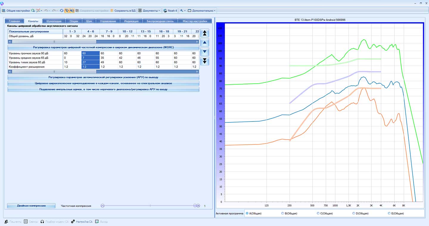 Как технологии «Атом» обеспечивают значительное повышение разборчивости речи (особенно в шуме) по данным НМИЦО ФМБА России фото: Как технологии «Атом» обеспечивают значительное повышение разборчивости речи (особенно в шуме) по данным НМИЦО ФМБА России