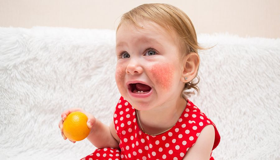 Аллергия у детей – статистика случаев и как предотвратить фото: Аллергия у детей – статистика случаев и как предотвратить