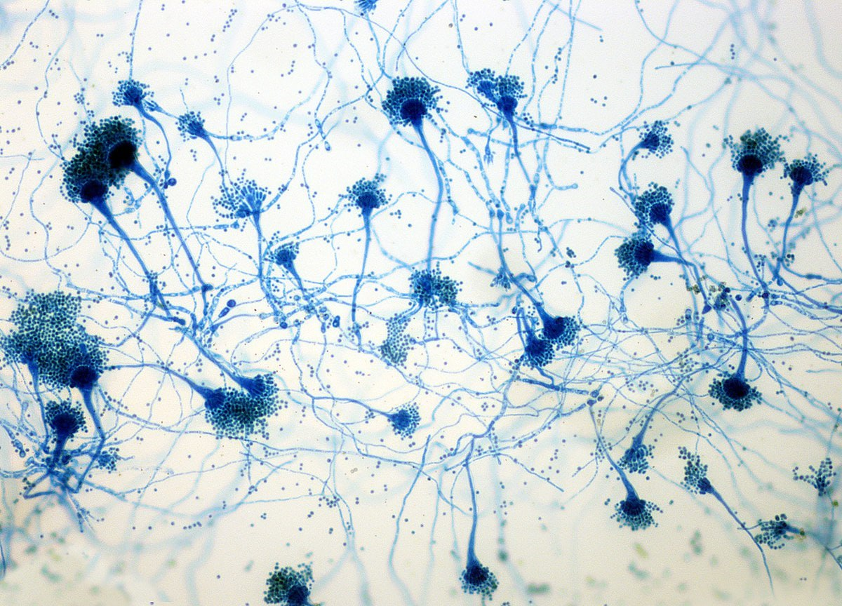 Грибок, которого стоит опасаться: кому он грозит и как защититься фото: Грибок, которого стоит опасаться: кому он грозит и как защититься