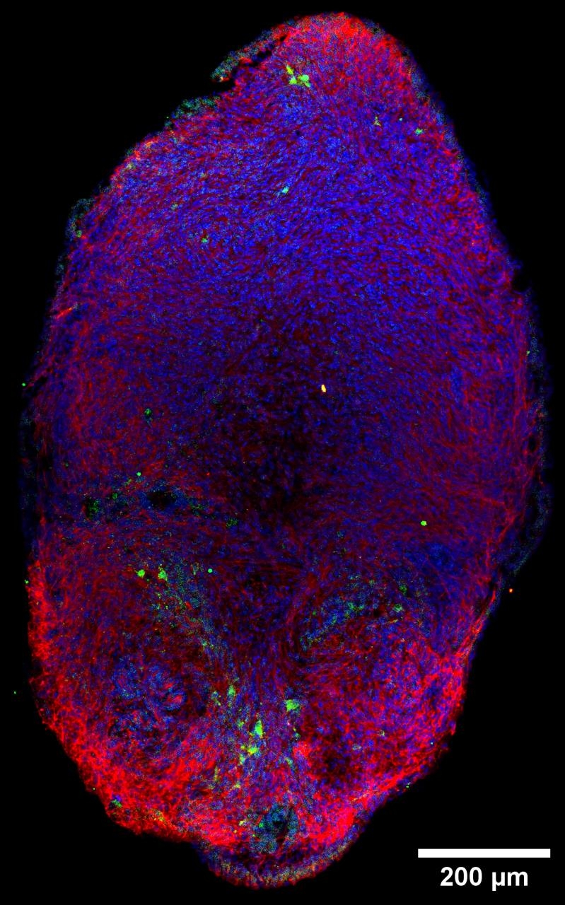 Получение органоидов среднего мозга для изучения и терапии болезни Паркинсона фото: Получение органоидов среднего мозга для изучения и терапии болезни Паркинсона