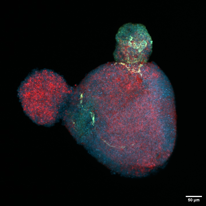 Эмбриоидное тельце или "кюсу из ИПСК" фото: Эмбриоидное тельце или "кюсу из ИПСК"