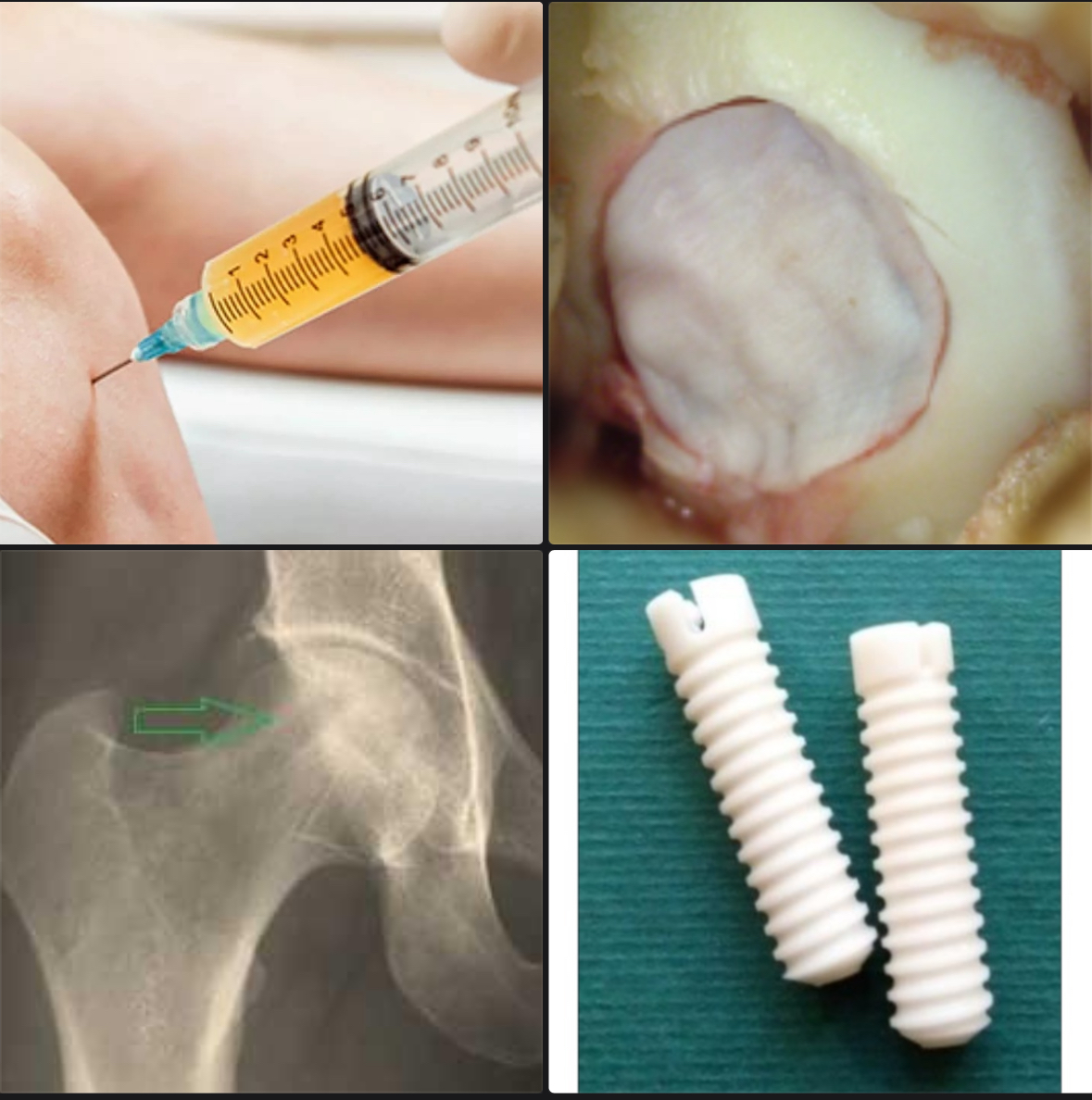 СНК Травматалогии и ортопедии Пироговского Университета о биотехнологиях фото: СНК Травматалогии и ортопедии Пироговского Университета о биотехнологиях