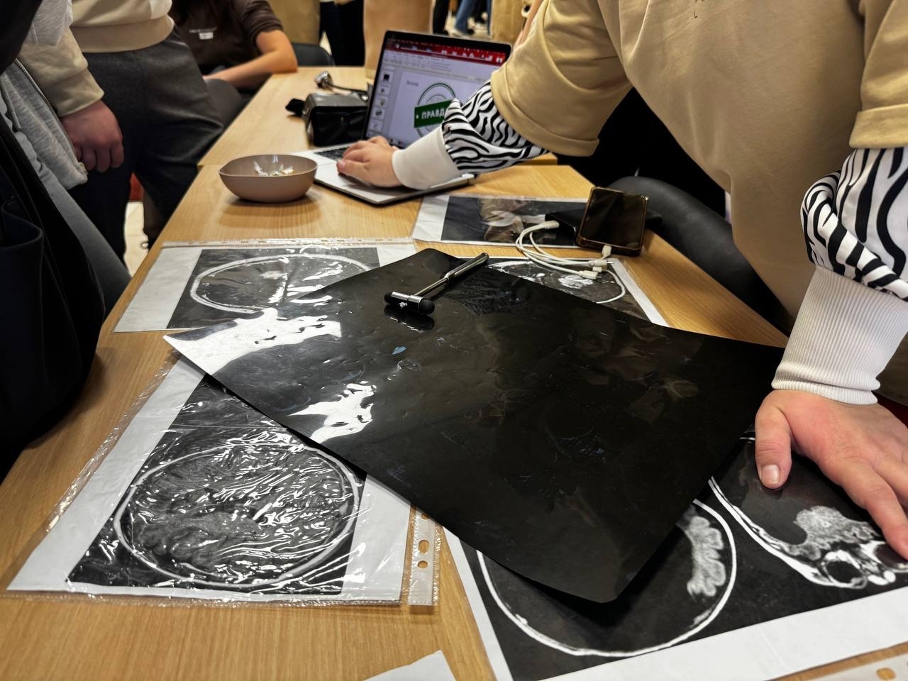 СНК кафедры неврологии, нейрохирургии и медицинской генетики имени академика Л.О. Бадаляна Пироговского Университета принял участие в очередном Пирогов Фесте фото: СНК кафедры неврологии, нейрохирургии и медицинской генетики имени академика Л.О. Бадаляна Пироговского Университета принял участие в очередном Пирогов Фесте