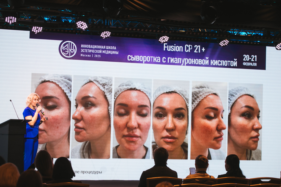 фото: Пресс-релиз: Umetex Aesthetics на ИШЭМ-2025: инновации, премии и новые горизонты эстетической медицины