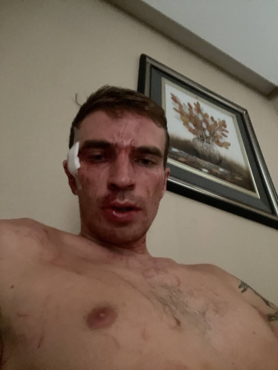 фото: Семь ножевых ранений: на сына Сергея Мавроди Максима Мернеса было совершено покушение 