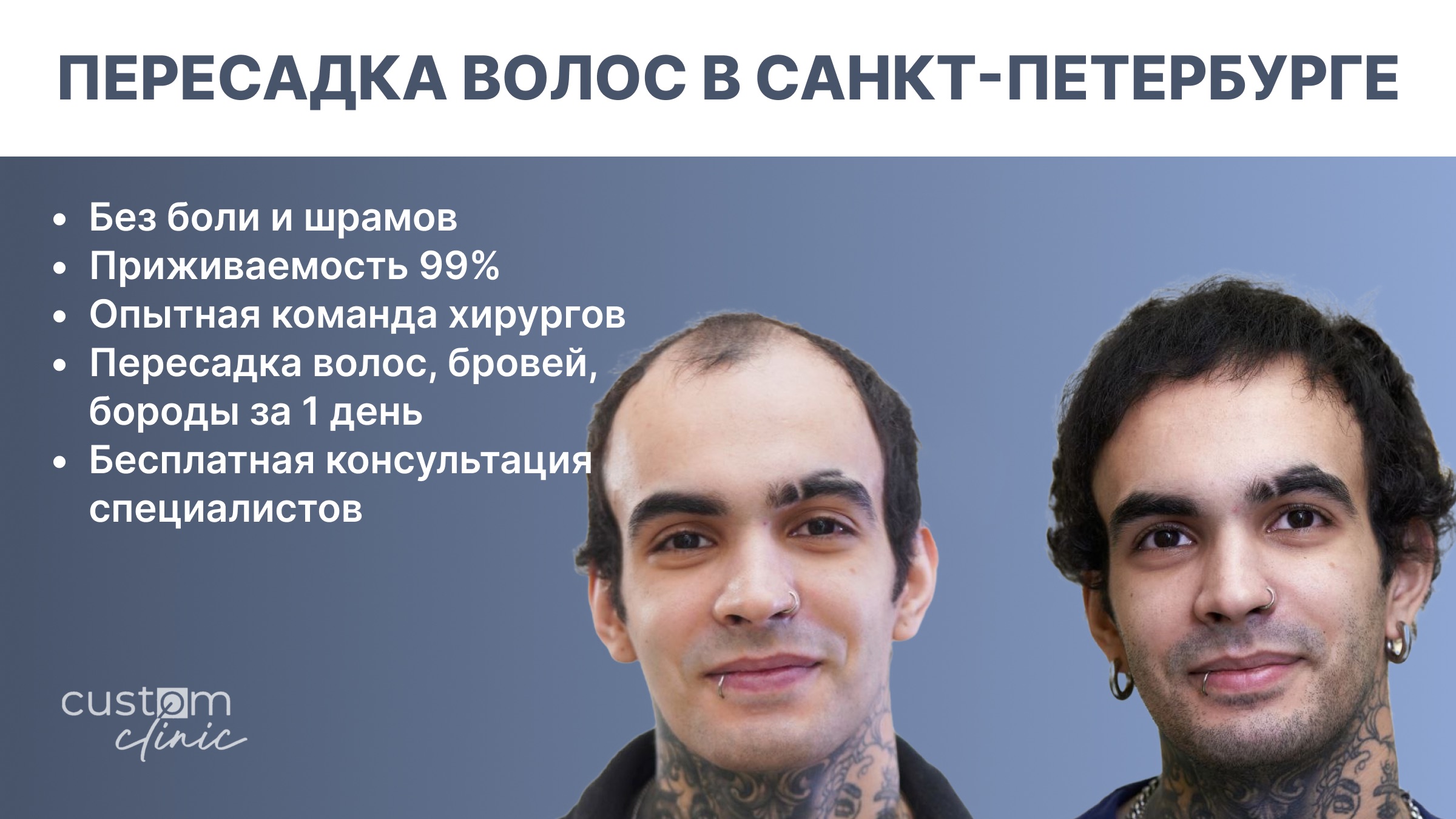фото: Custom Clinic - это клиника в центре Санкт-Петербурга, где решают проблему выпадения волос комплексно и эффективно