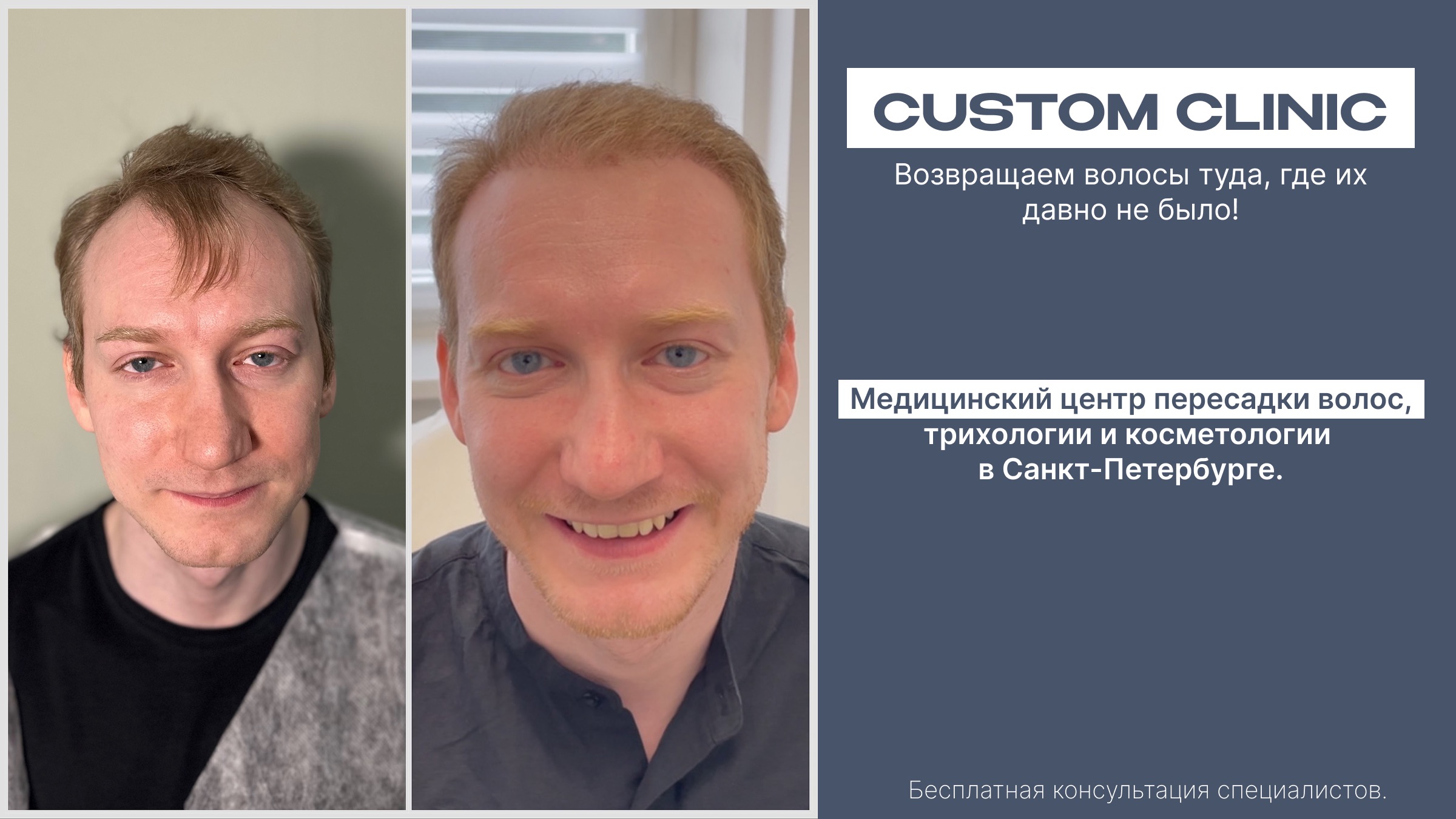 фото: Custom Clinic - это клиника в центре Санкт-Петербурга, где решают проблему выпадения волос комплексно и эффективно