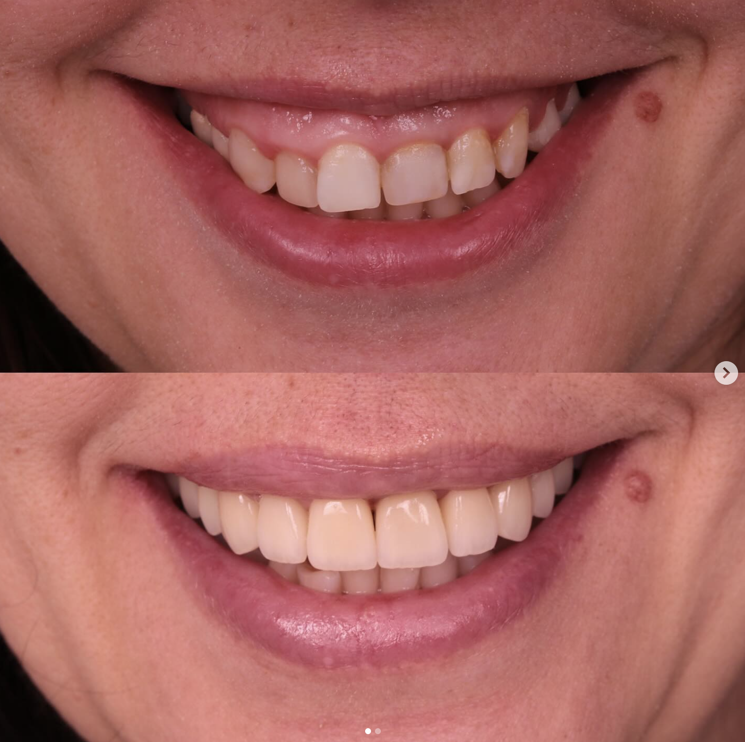 фото: Стоматолог в Москве - VINICHENKO DENTAL PRACTICE