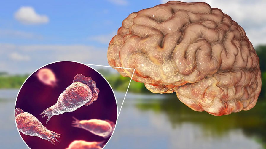 фото: Naegleria fowleri: правда ли амёба может убить и как избежать заражения?