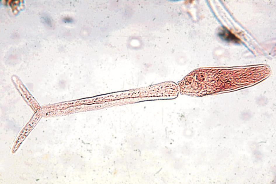 фото: Зуд купальщика: как распознать и лечить церкариоз