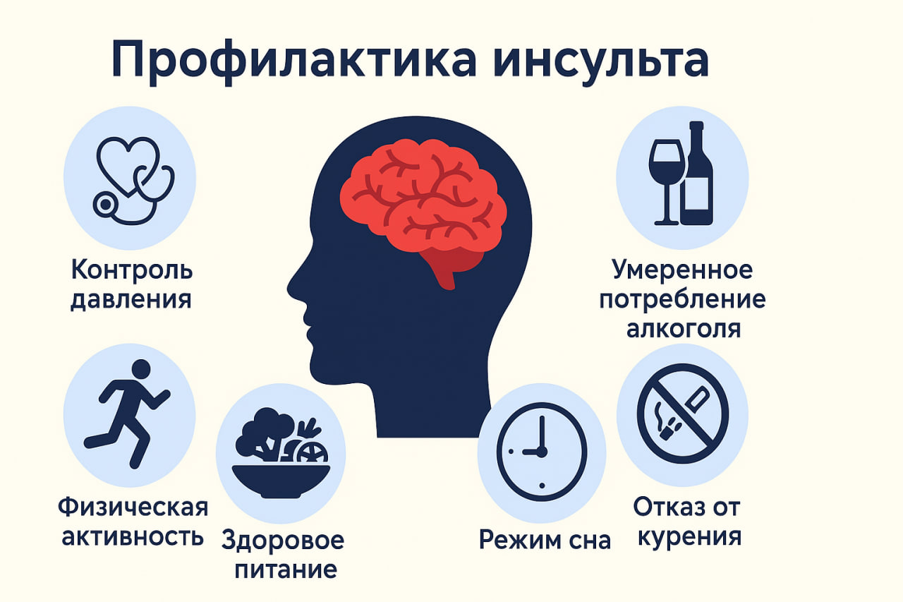 Инсульт можно предотвратить: простые шаги к здоровой жизни