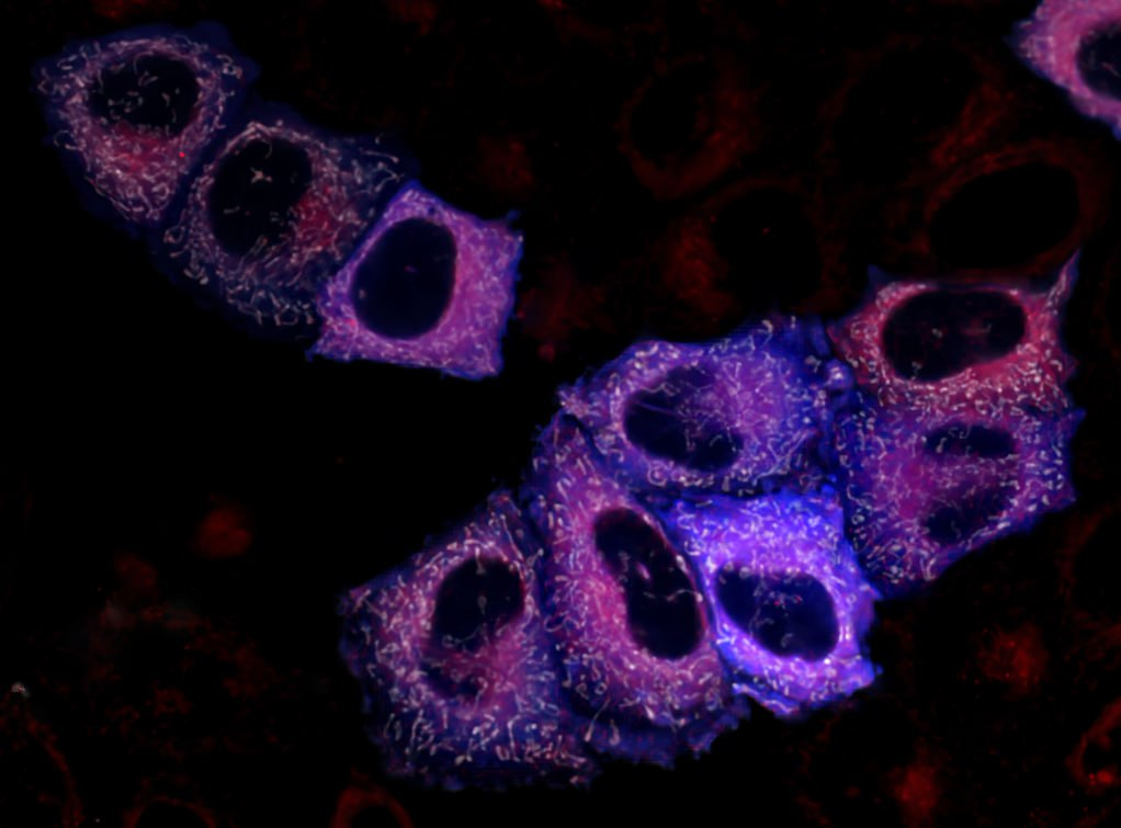 Прорыв в диагностике: ученые Пироговского Университета создали биосенсоры для сверхраннего выявления болезней