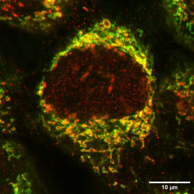 фото: Генномодифицированные Pfa1, окрашенные антителами к APEX2-MICU1 и Tom20