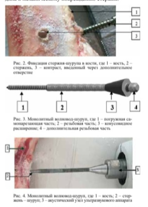 фото: СНК Травматологии и ортопедии Пироговского Университета рассказывает о ультразвуковой сварке костной ткани